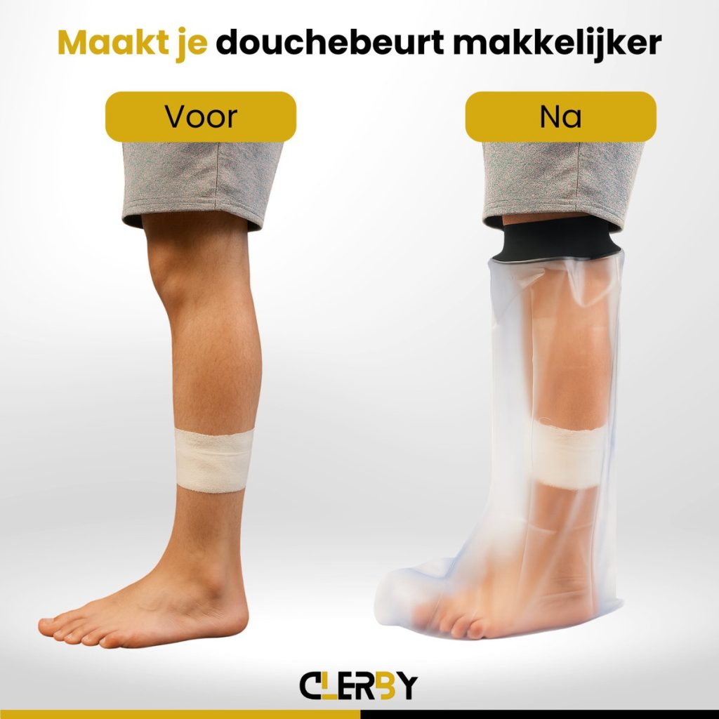 Vergelijking van been voor en na het dragen van een doorzichtige plastic douchehoes over een verband.